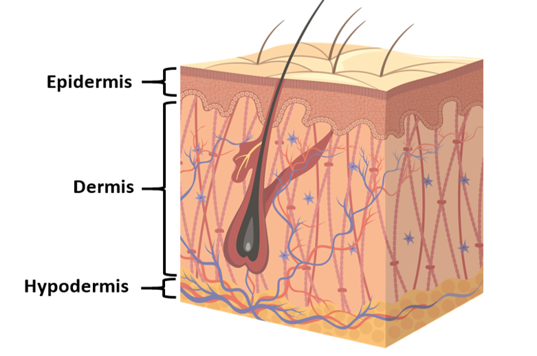 Drawing of skin layers featuring Epidermis, Dermis and Hypodermis