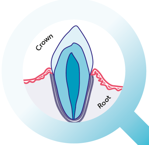 zoom in tooth structure